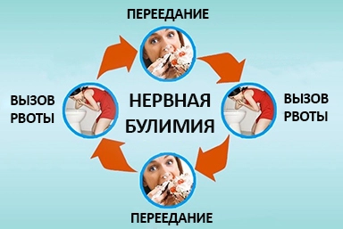 Лечение булимии в Бузулуке